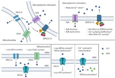 Influence of Obesity and Type 2 Diabetes on Calcium Handling by Skeletal Muscle: Spotlight on the Sarcoplasmic Reticulum and Mitochondria